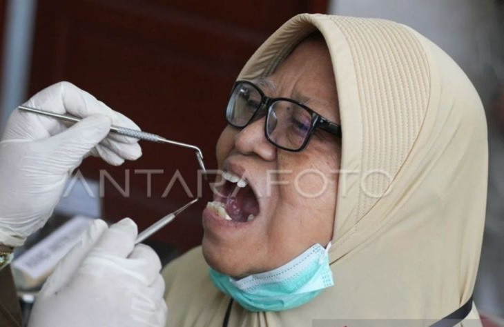 Pola Buka Puasa Untuk Cegah Gigi Berlubang, Begini Tipsnya dari Dokter