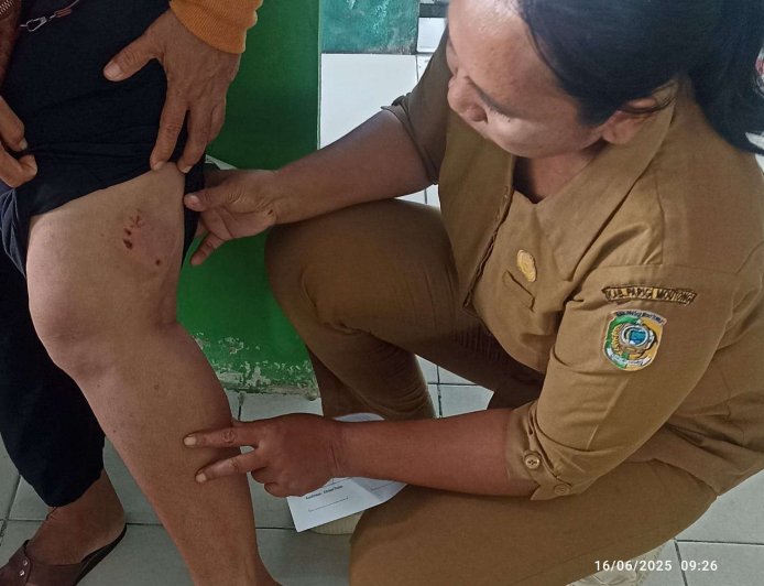 Tiga Warga Meninggal, Parimo Tetapkan KLB Rabies