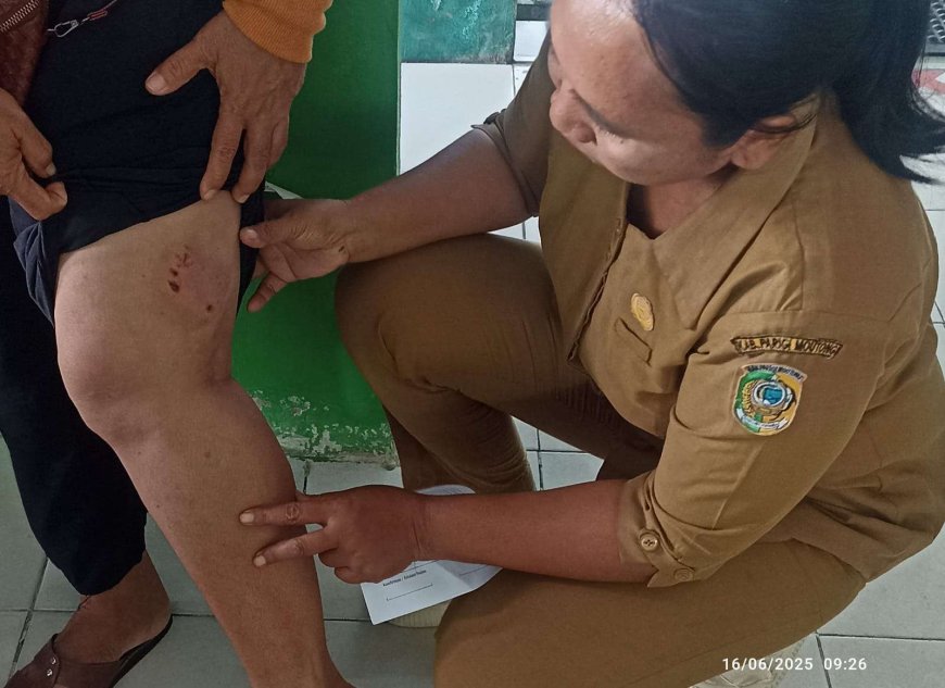 Tiga Warga Meninggal, Parimo Tetapkan KLB Rabies