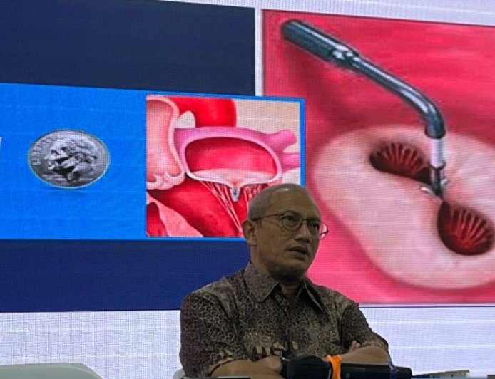 Penanganan Masalah Katup Jantung Bisa Dilakukan Tanpa Operasi