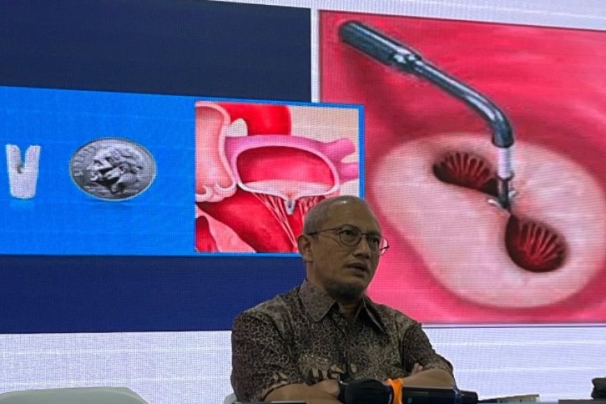 Penanganan Masalah Katup Jantung Bisa Dilakukan Tanpa Operasi